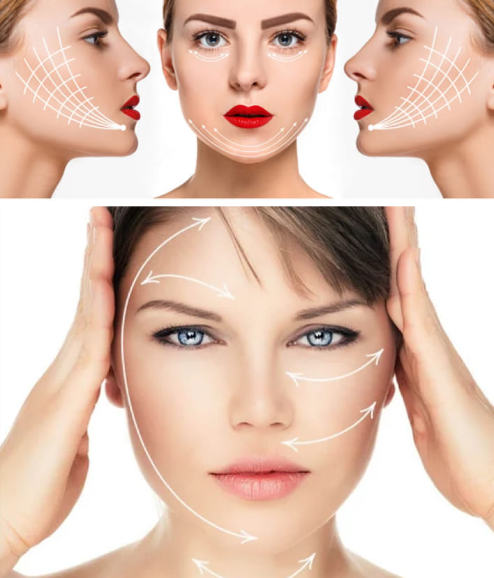 What is Thread Lifting?